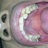 KROM